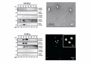 Exosome：為腫瘤臨床診斷和治療帶來新的契機(jī)